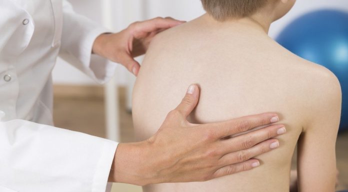 Kaip užbėgti už akių vaikų skoliozei?